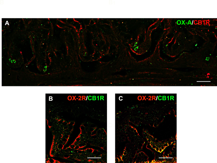Fluorescence microscopy, OX-A/CB1R, OX-2R/CB1R, neural tissue analysis, image A-C, signal localization.