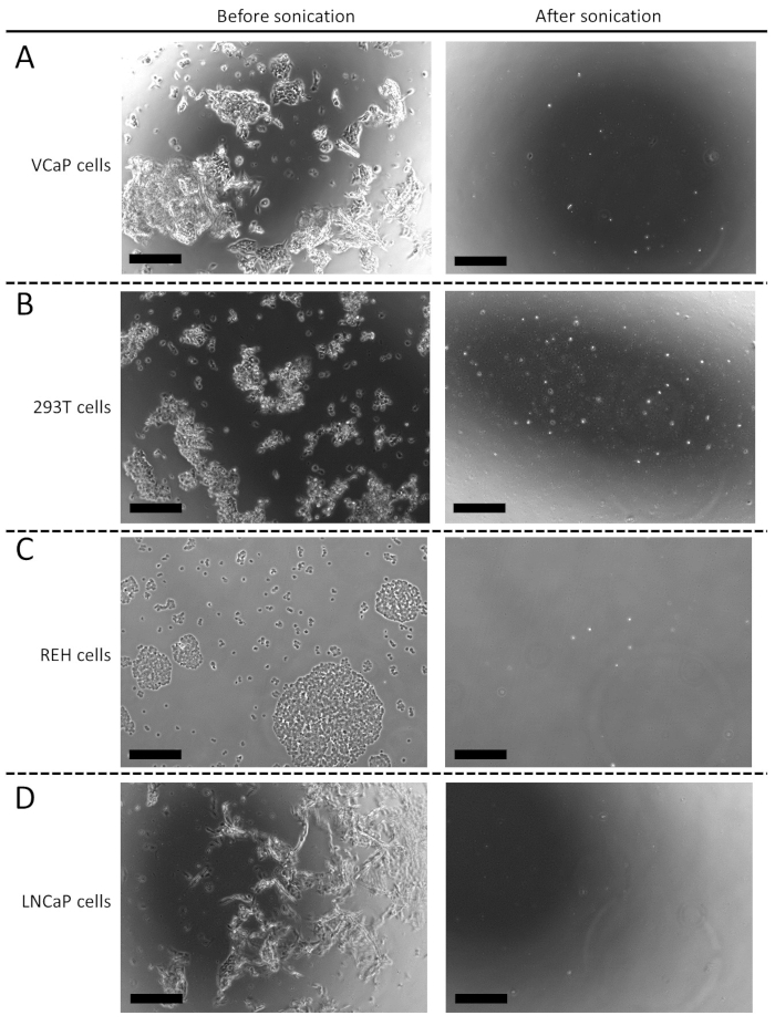 figure-results-1 Cell morphology before and after sonication; microscope images of VCaP, 293T, REH, LNCaP cells.