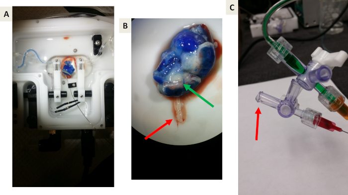 figure-results-5 Surgical setup with dye injection for tissue analysis; microscopy image of dyed tissue; catheter system.