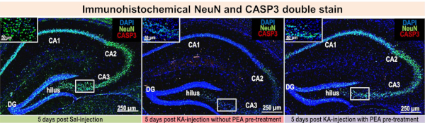 Immunohistochemical NeuN CASP3 double stain, microscopy images; brain region comparison.
