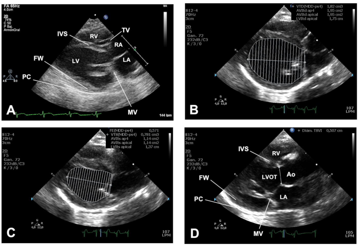 Normal Rabbit Echo Video: Transthoracic Echocardiographic Examination in the Rabbit Model