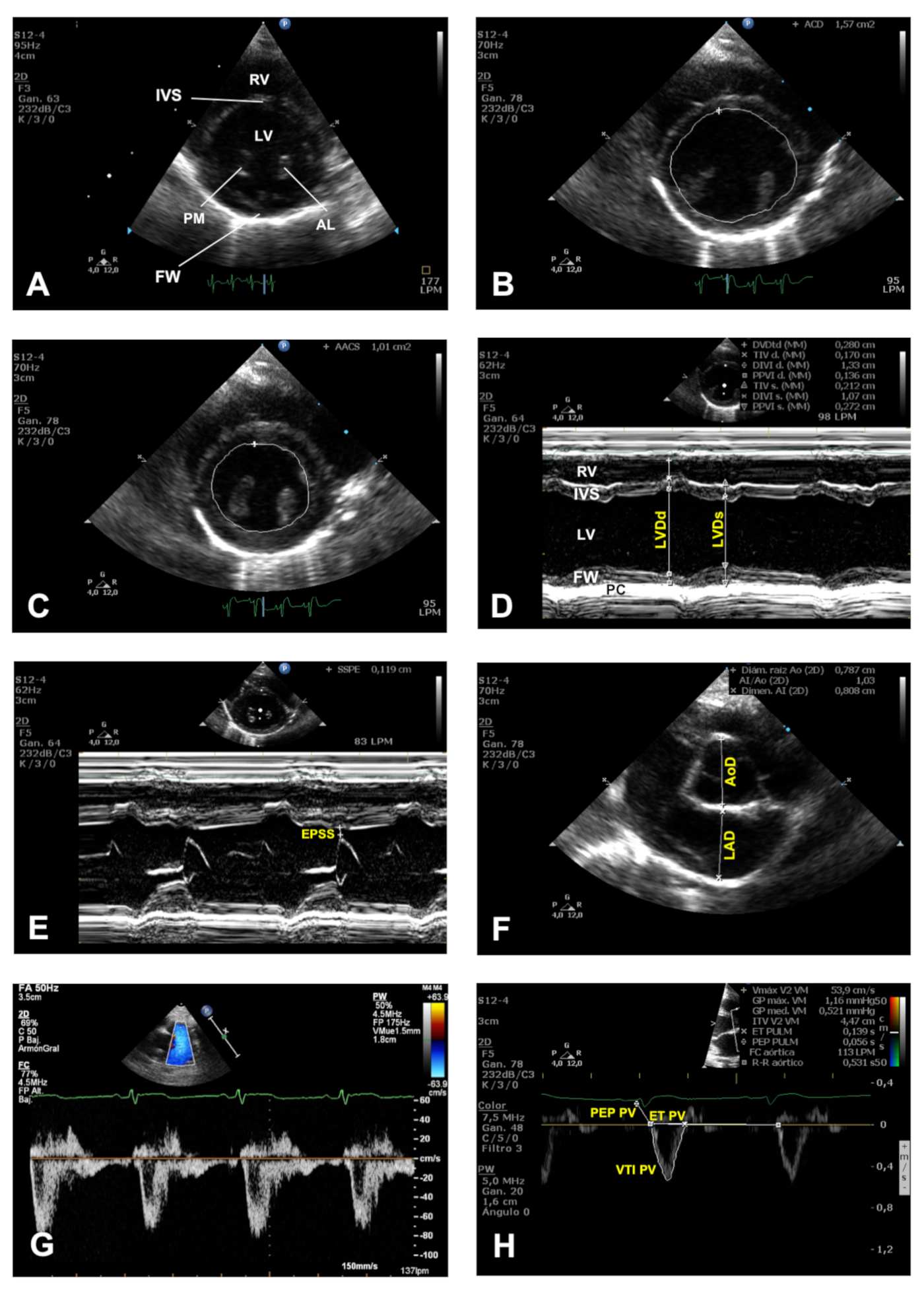 Normal Rabbit Echo Video: Transthoracic Echocardiographic Examination in the Rabbit Model