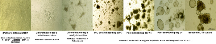 Stem cell differentiation stages, microscopic images; iPSC, endoderm, hindgut, organoid formation.