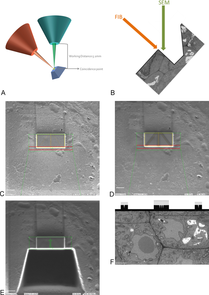 FIB-SEM diagram and images; microstructural analysis; focused ion beam, scanning electron microscopy.
