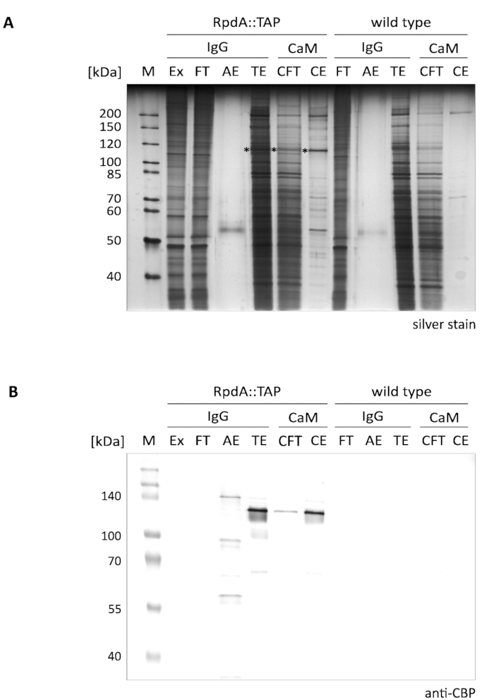 Protein purification electrophoresis results; silver stain and anti-CBP; SDS-PAGE analysis; RpdA::TAP system.