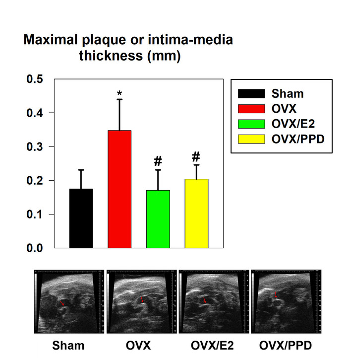 Bar graph with ultrasound results showing plaque thickness in different treatment groups: Sham, OVX, OVX/E2, OVX/PPD.