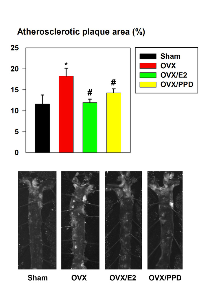 Atherosclerotic plaque comparison; bar chart and microscopy images; treatments: Sham, OVX, OVX/E2, OVX/PPD.