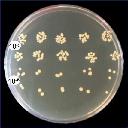 Bacterial culture growth on agar plate; dilution series; colony counting; microbiology experiment.