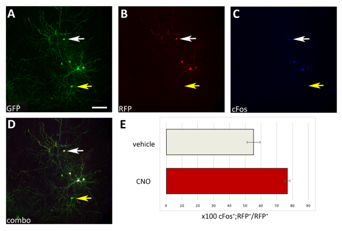 Fluorescent imaging of neurons; GFP, RFP, cFos expression; analysis graph of vehicle vs. CNO.