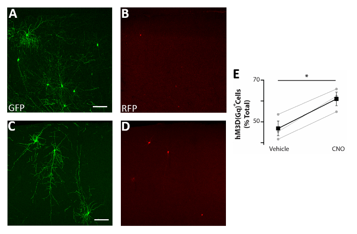 Neuronal fluorescence microscopy GFP RFP images with quantitative cell activity graph analysis.