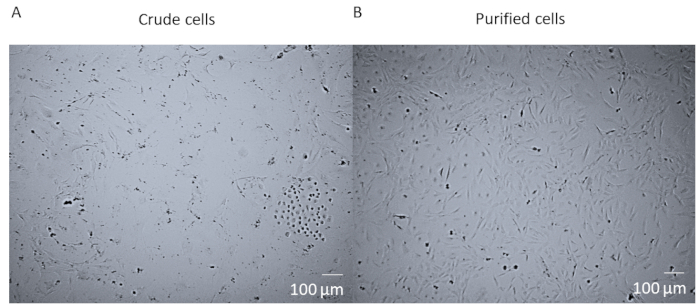 Microscope image comparing crude vs. purified cells; showcases cell purification process, 100 µm scale.