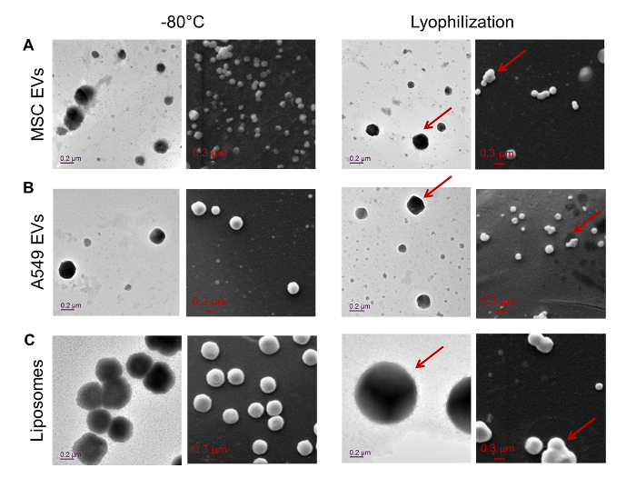 figure-results-6 Electron microscopy of cryopreserved vs lyophilized vesicles and liposomes; structure analysis.