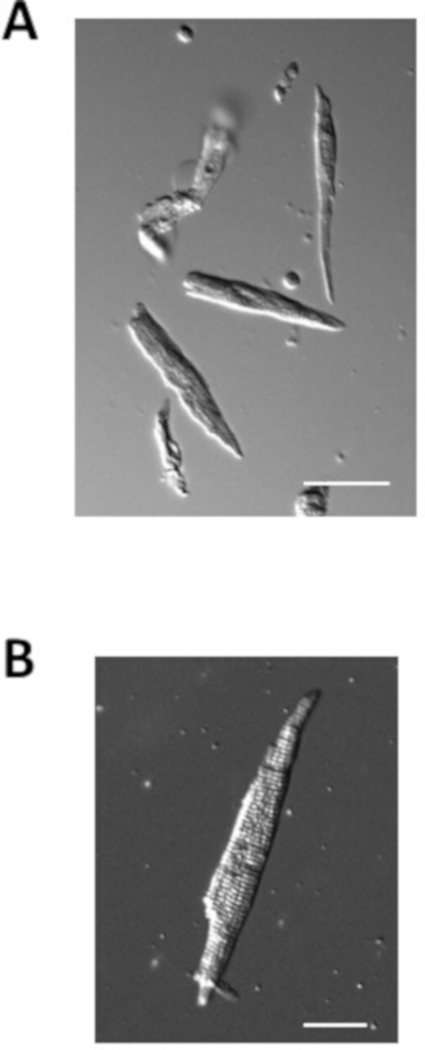 Microscopy, diatom structures; image A, multiple diatoms, image B, single diatom close-up.