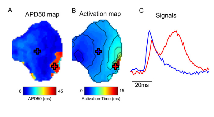 APD50 e mappe di attivazione con segnali; dati di elettrofisiologia cardiaca, grafico di analisi del segnale.