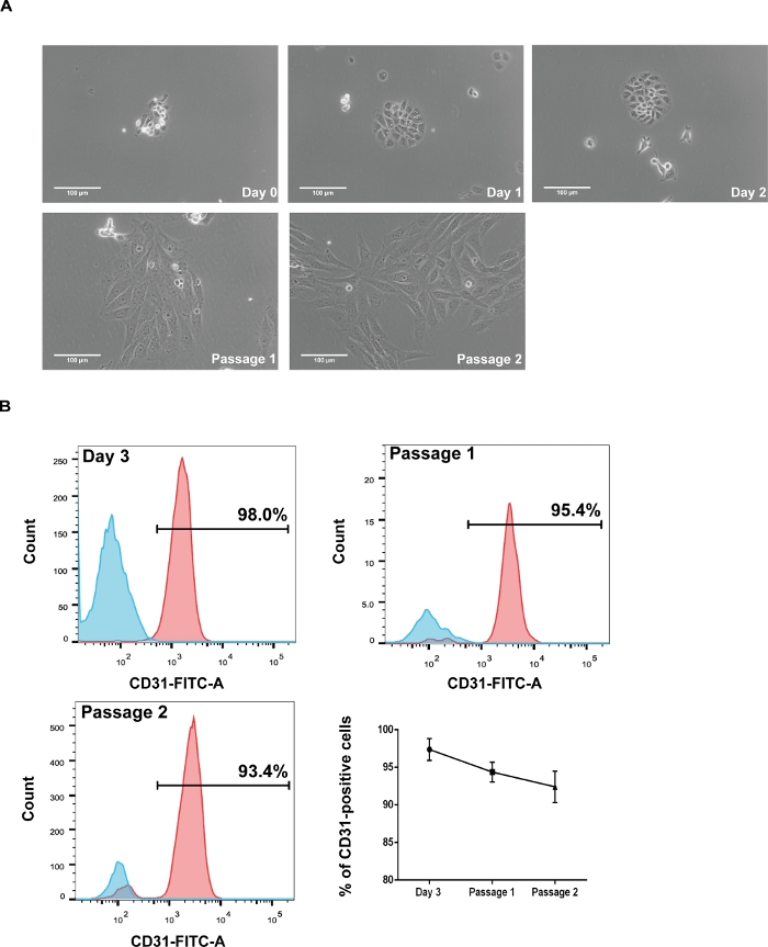 figure-results-3 Cell culture growth and flow cytometry analysis, microscopy images A, CD31-FITC-A fluorescence graphs B.