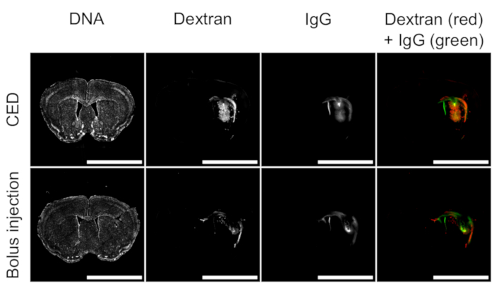 Fluorescence microscopy of CED vs. bolus injection; DNA, Dextran, IgG distribution; brain slices.