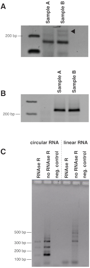 figure-results-5 Electrophoresis results for circular vs linear RNA using RNase R treatment, gel diagram, 100-500 bp.