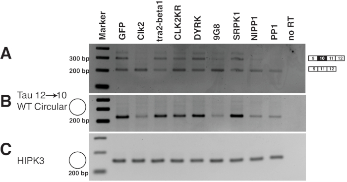 figure-results-6 PCR electrophoresis results diagram, DNA bands for gene expression analysis, 200-300 bp markers.