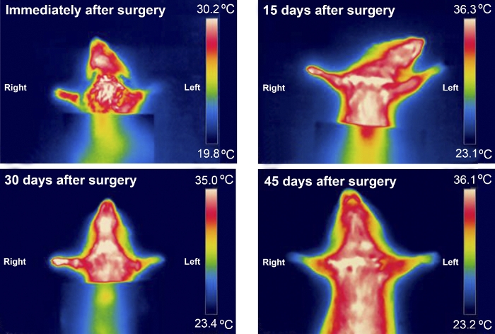 Thermographic analysis post-surgery, heat distribution over 45 days, temperature scale, diagram.