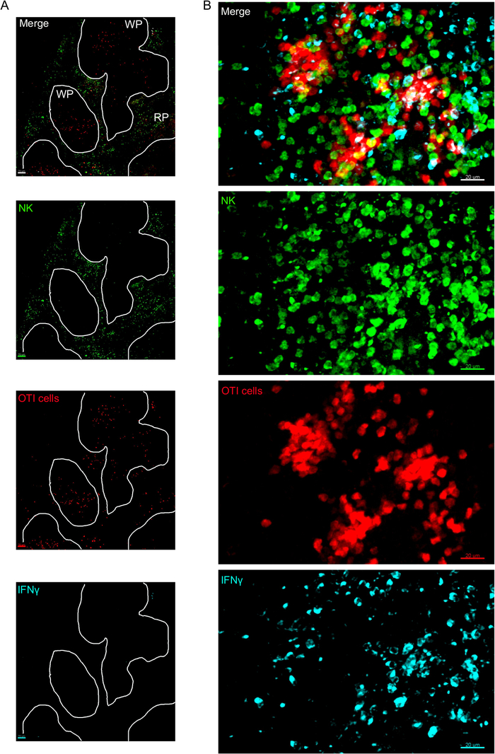 figure-results-3 Fluorescence microscopy imaging, NK and OTI cell distribution, immune response, spleen sections.