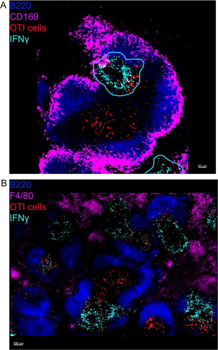 figure-results-4 Immunofluorescence microscopy of B220, CD169, OTI cells, IFNγ in spleen tissue, 50μm and 100μm.