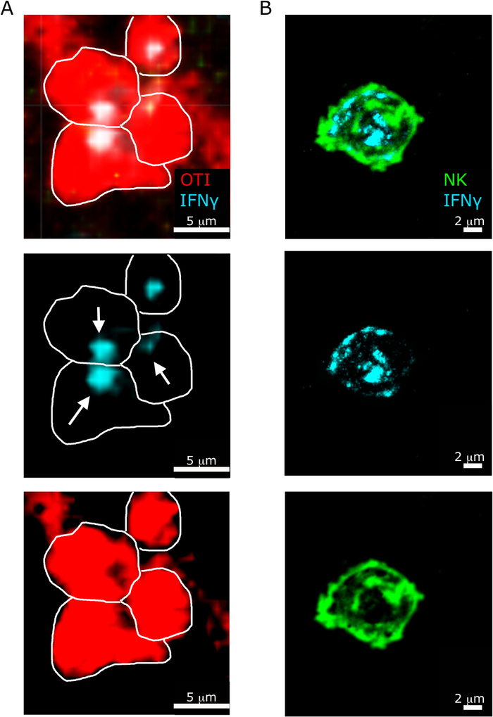 figure-results-6 Fluorescence microscopy of IFNγ in immune cells; subcellular localization, 5µm, 2µm scale bars.