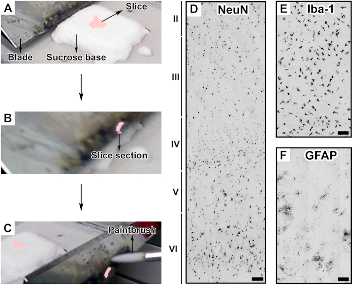 Brain slice preparation diagram; NeuN, Iba-1, GFAP staining results; microscopy image analysis.