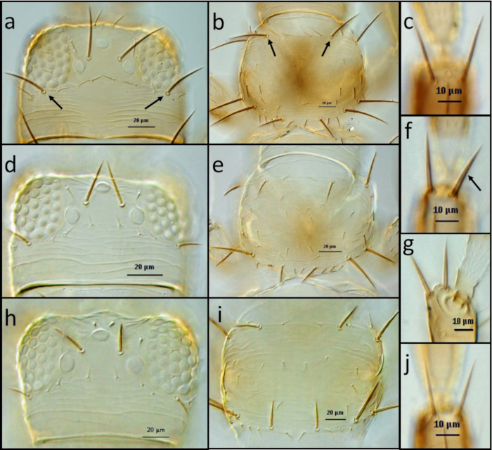 Microscopy image of setae structures on insect body parts; scale bars denote measurement units.