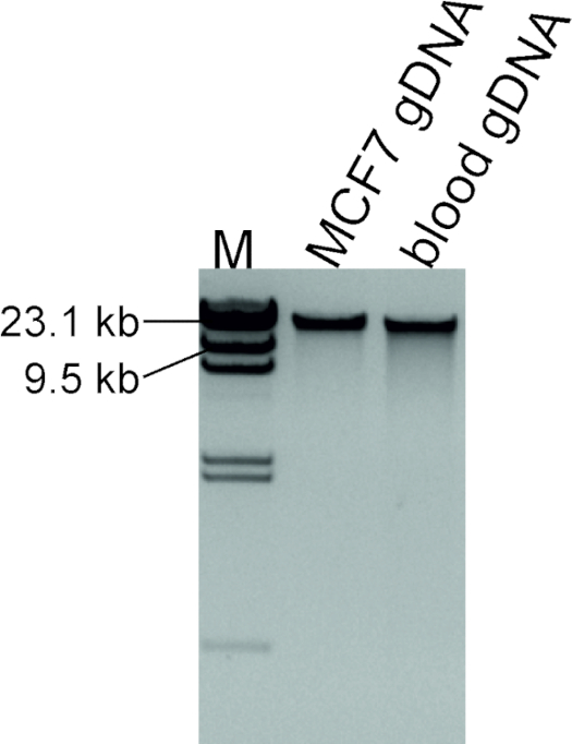 figure-results-2 DNA electrophoresis gel, gDNA separation, MCF7, blood, molecular marker, kb migration pattern.