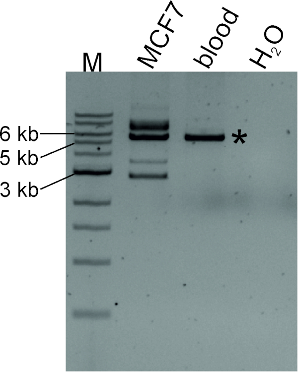 figure-results-4 Electrophoresis result; DNA band separation, gel lanes M, MCF7, blood, and H<sub>2</sub>O indicated.