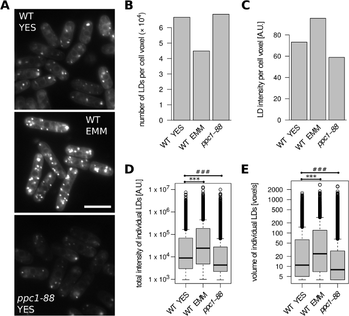 figure-results-2 Yeast lipid droplet analysis, microscopy images, bar and box plots; WT, EMM, YES comparison.