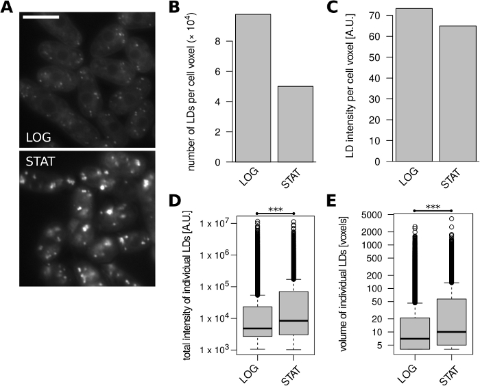 figure-results-3 Microscopy and chart analysis of lipid droplets in LOG and STAT phases; statistical results shown.