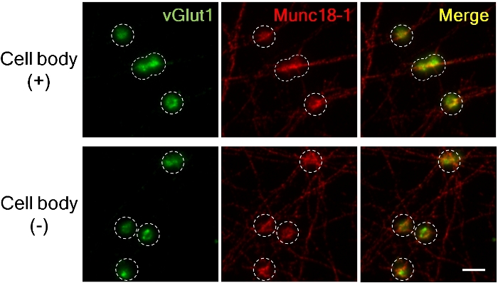 figure-results-3 Fluorescence microscopy image, vGlut1 and Munc18-1 proteins in cell bodies; protein co-localization.
