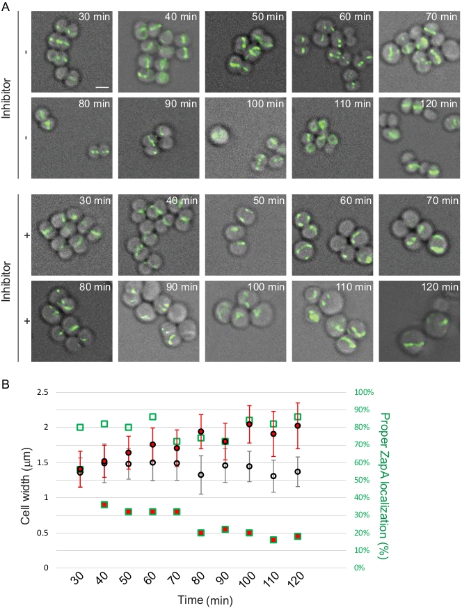 Time-lapse microscopy; cell division with inhibitor; fluorescence imaging; cell width graph analysis.