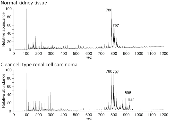 figure-results-4 Mass spectrometry graph comparing normal kidney tissue and renal carcinoma; m/z, relative abundance.