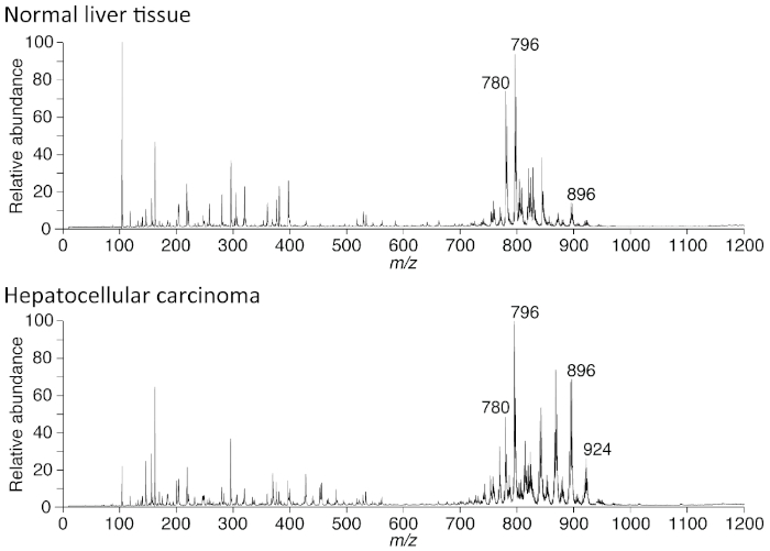 figure-results-5 Mass spectrometry analysis; spectra; liver tissue vs hepatocellular carcinoma; relative abundance, m/z.