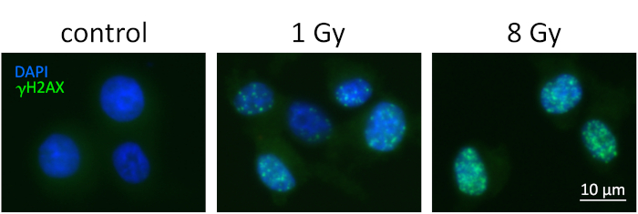 figure-results-8 Fluorescence microscopy of γH2AX foci; cell DNA damage response with DAPI staining; doses: control, 1 Gy, 8 Gy.