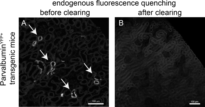 Parvalbumin-YFP fluorescence quenching in transgenic mice; confocal microscopy, pre and post-clearing.