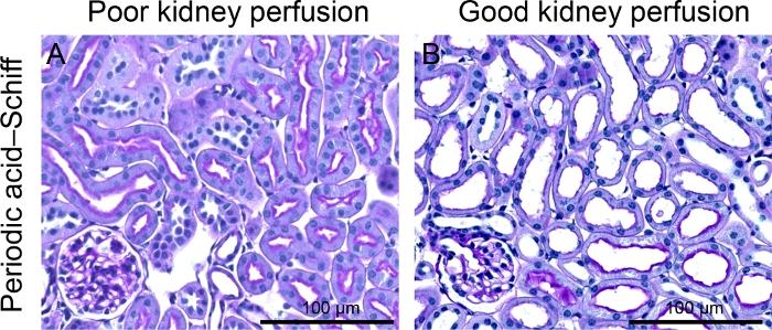 Kidney perfusion comparison via periodic acid-Schiff microscopy, showing poor vs. good results.