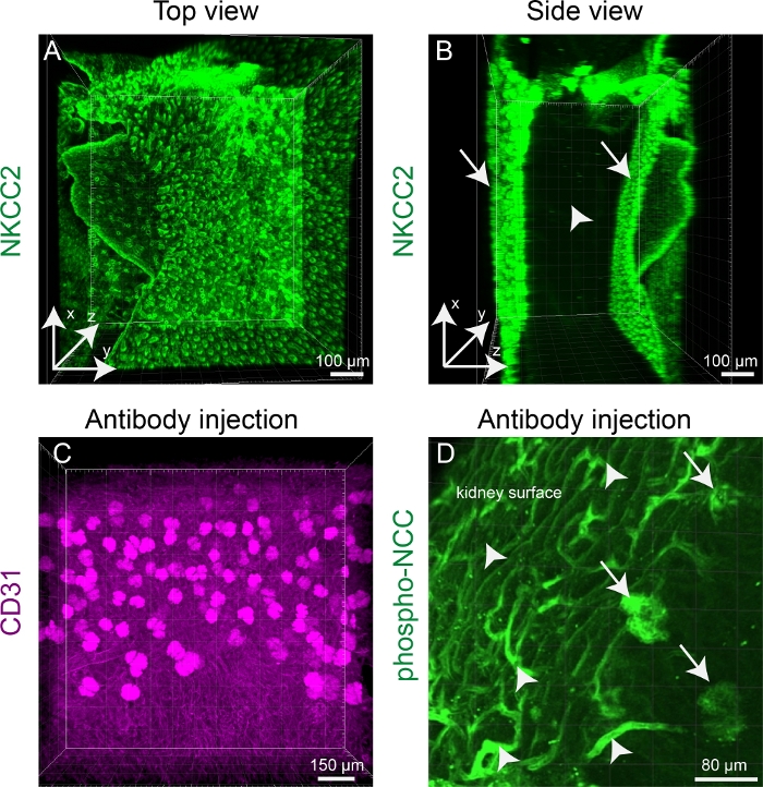 NKCC2, CD31, phospho-NCC confocal microscopy; kidney structure; antibody injection analysis.