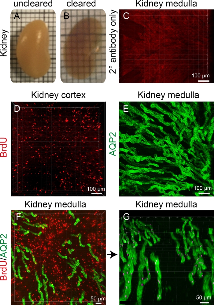 Kidney tissue clearing and immunofluorescence; aquaporin-2, BrdU, confocal microscopy results.