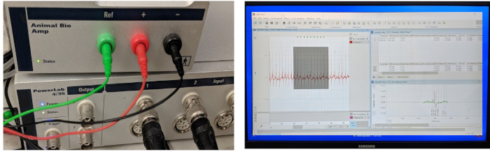 figure-results-3 Biopotential recording setup with data analysis; features animal bio amplifier and monitoring software.