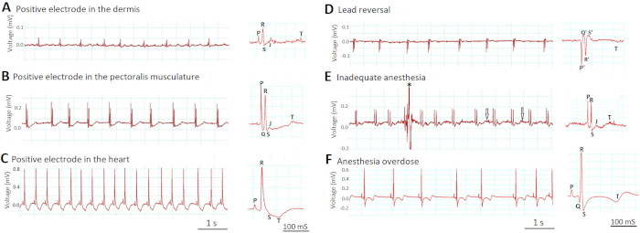 figure-results-6 ECG chart: electrode positions, lead reversal, anesthesia levels, voltage traces, time intervals.