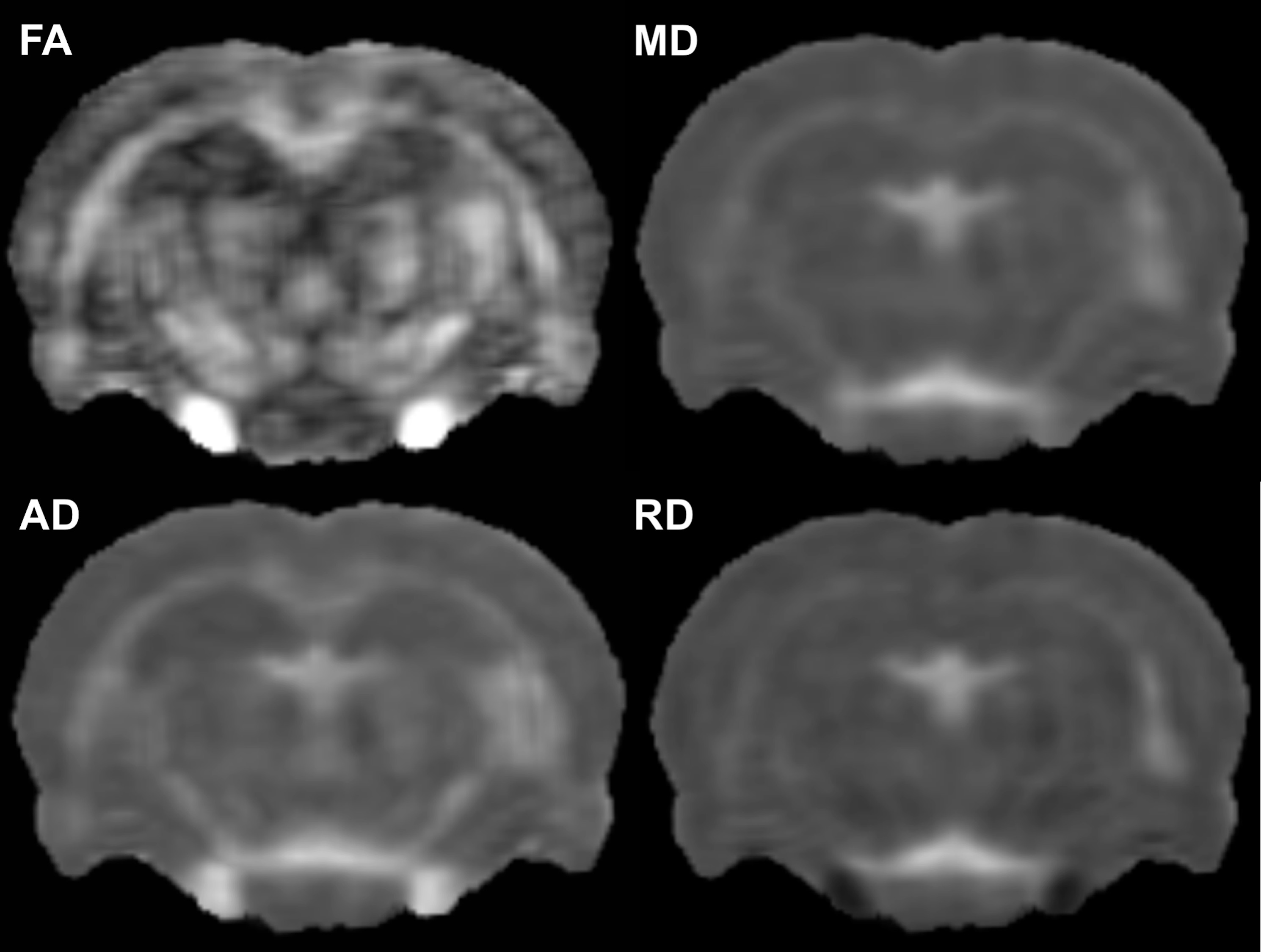 Observation d'images obtenues en Imagerie par Résonance Magnétique (IRM)  sur la console d'acquisitio