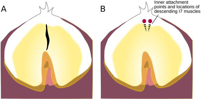 figure-protocol-4 Schema di attacco muscolare, punti muscolari I7 interni contrassegnati in sezione anatomica, uso didattico.