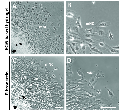 figure-results-3 Cell morphology comparison, ECM hydrogel vs. fibronectin, microscopy images, mNC, pNC, NP labeling.