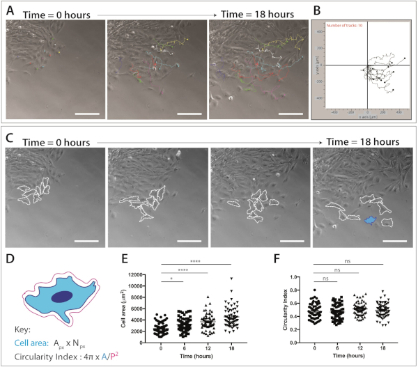 figure-results-4 Cell migration analysis: time-lapse microscopy, cell tracking, area, and circularity graphs included.