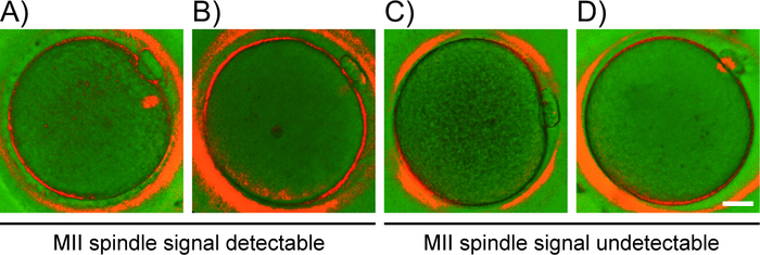 MII spindle detection in microscopic images, showcasing signal presence and absence; fluorescence microscopy.