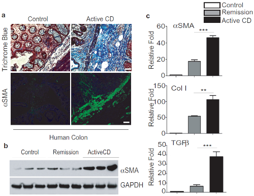 figure-results-2 Human colon analysis, trichrome staining, αSMA expression; protein gel and fold change comparison.