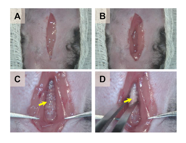 figure-results-1 Surgical wound healing stages, close-up, showing tissue regeneration process, clinical images.
